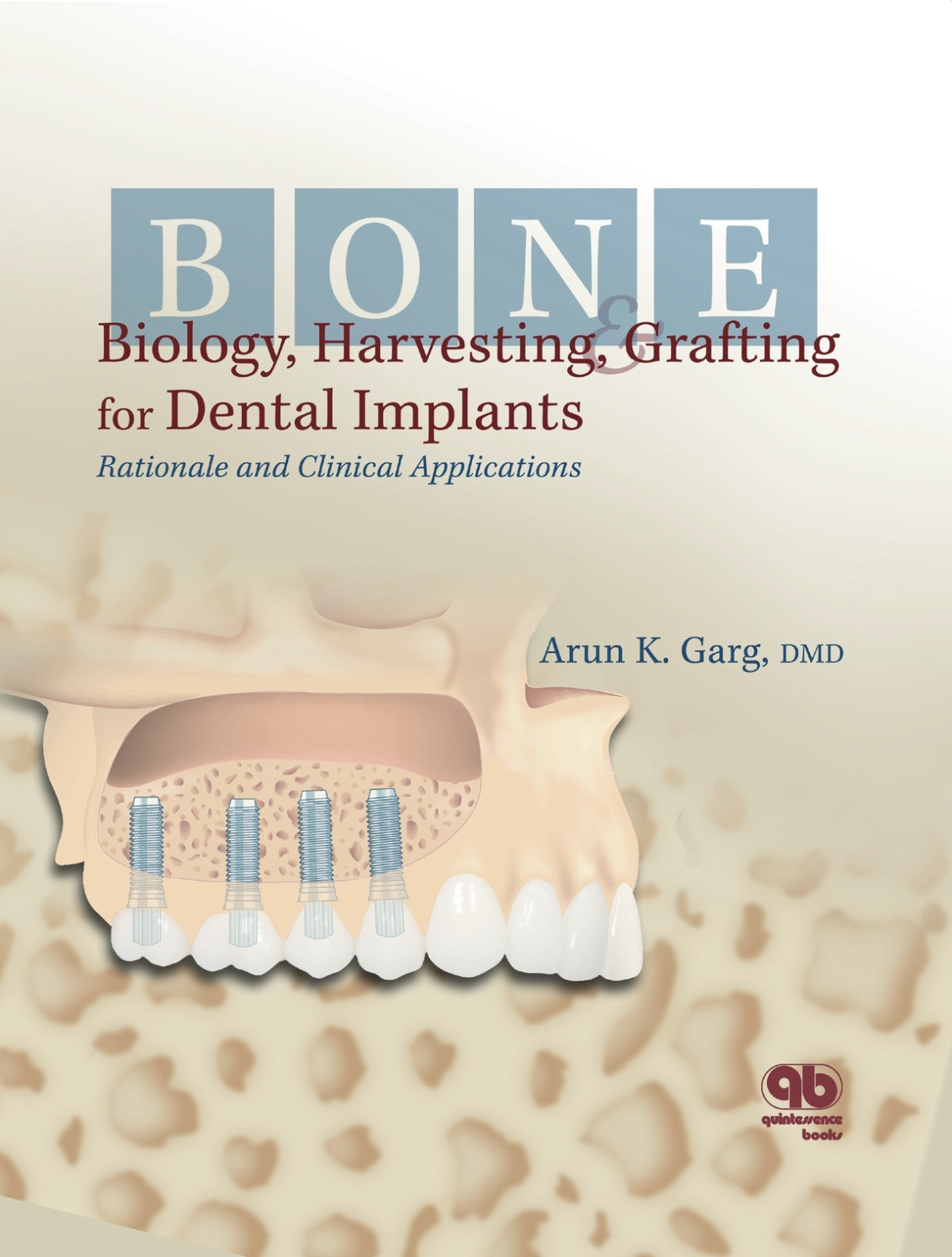 Bone Biology Harvesting Grafting For Dental Implants Arun K Garg