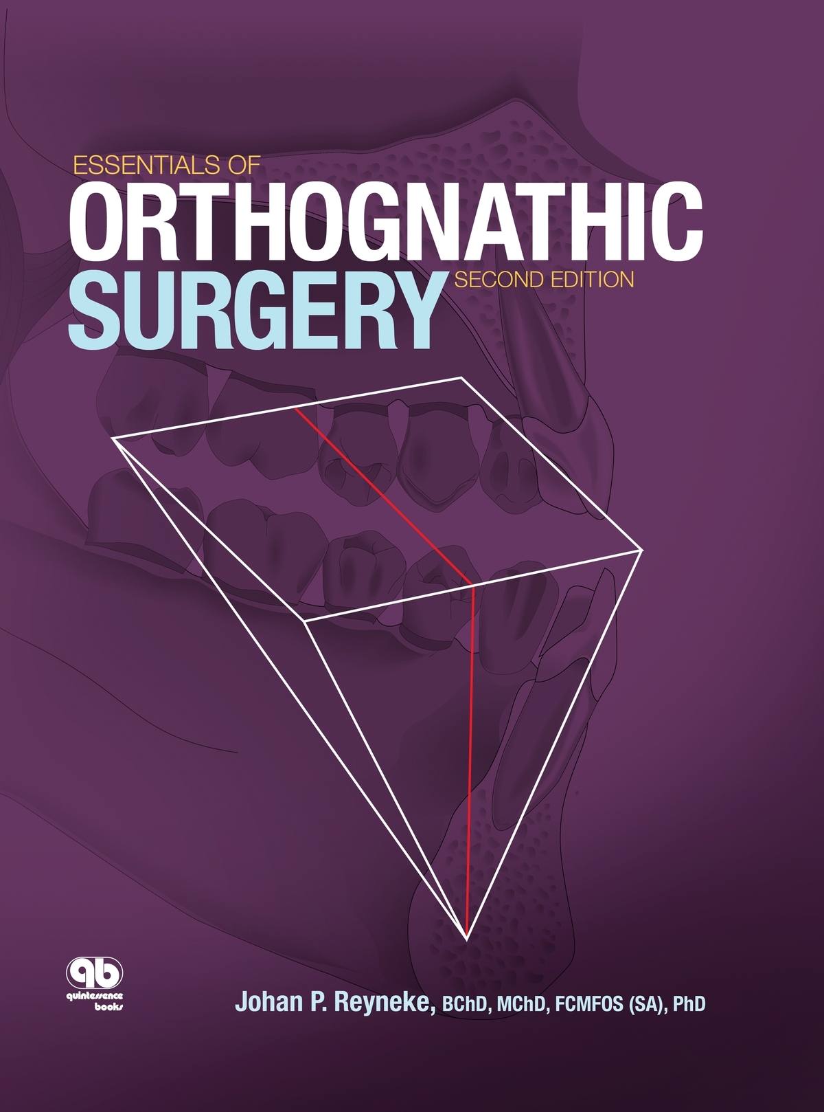 Essentials Of Orthognathic Surgery Second Edition Johan P Reyneke