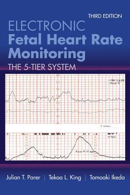 Electronic Fetal Heart Rate Monitoring The 5tier System Third Julian T Parer Tekoa L King Tomaki Ikeda