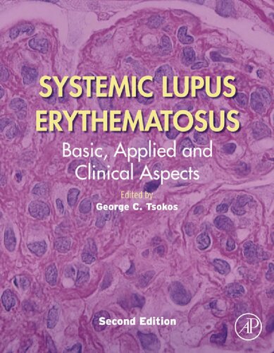 Systemic Lupus Erythematosus Basic Applied And Clinical Aspects 2nd Edition George Tsokos Editor