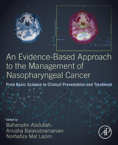 An Evidencebased Approach To The Management Of Nasopharyngeal Cancer From Basic Science To Clinical Presentation And Treatment 1st Edition Baharudin Abdullah Editor