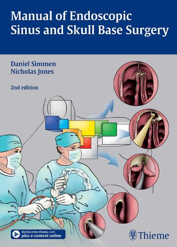 Manual Of Endoscopic Sinus And Skull Base Surgery 2nd Edition Daniel Simmen