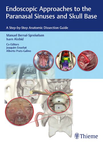 Endoscopic Approaches To The Paranasal Sinuses And Skull Base A Stepbystep Anatomic Dissection Guide Joaquim Enseat Manuel Bernalsprekelsen Alberto Pratsgalino Isam Alobid