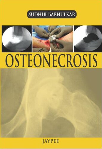 Osteonecrosis Sudhir Babhulkar