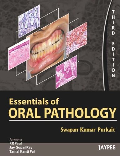 Essentials Of Oral Pathology 3rd Edition Swapan Kumar Purkait