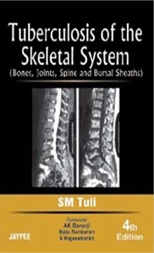 Tuberculosis Of The Skeletal System Bones Joints Spine And Bursal Sheaths 4th Edition Sm Tuli