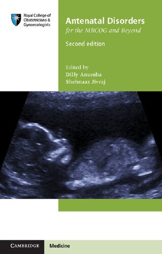 Antenatal Disorders For The Mrcog And Beyond 2nd Edition Dilly Anumba