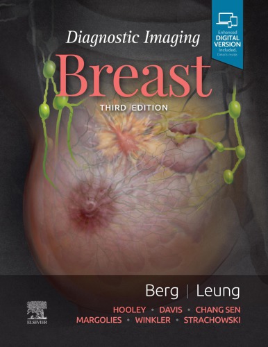 Diagnostic Imaging Breast Third Edition Wendie A Berg Jessica Leung