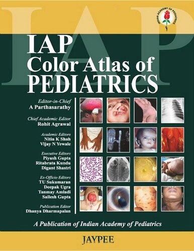 Iap Color Atlas Of Pediatrics Second Edition 2nd Edition A Parathasarathy
