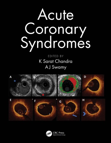 Acute Coronary Syndromes 1st K Sarat Chandra Aj Swamy