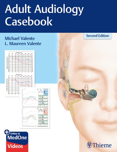 Adult Audiology Casebook Second Michael Valente L Maureen Valente