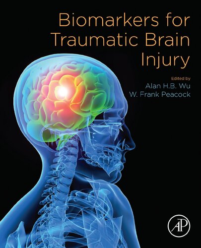 Biomarkers For Traumatic Brain Injury 1st Edition Alan Hb Wu Phd Editor