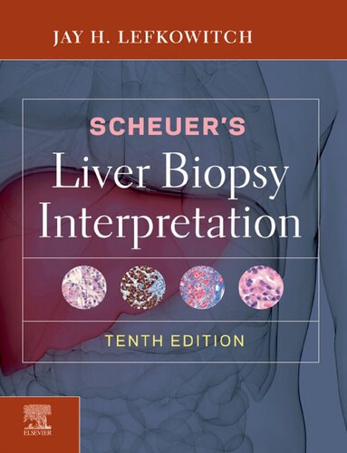 Scheuers Liver Biopsy Interpretation 10th Edition Jay H Lefkowitch Md
