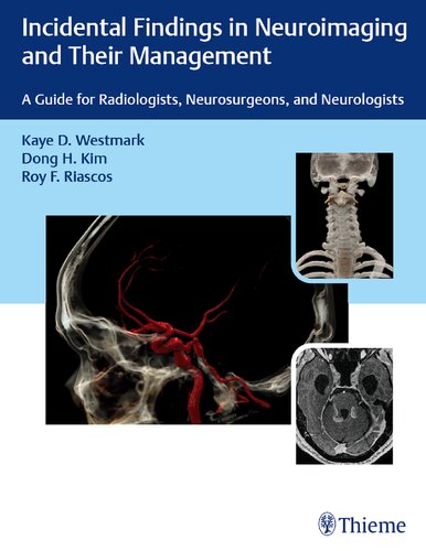 Incidental Findings In Neuroimaging And Their Management A Guide For Radiologists Neurosurgeons And Neurologists 1st Edition Kaye Westmark