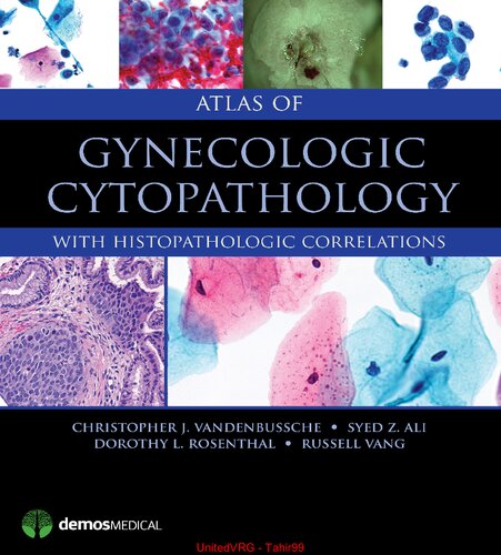 Atlas Of Gynecologic Cytopathology With Histopathologic Correlations 1st Edition Christopher J Vandenbussche Md Phd