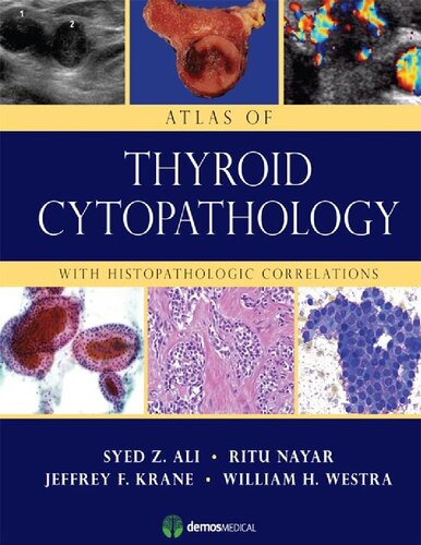 Atlas Of Thyroid Cytopathology With Histopathologic Correlations 1st Edition Syed Z Ali Md