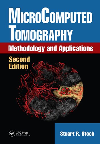 Microcomputed Tomography Methodology And Applications Second Stuart R Stock