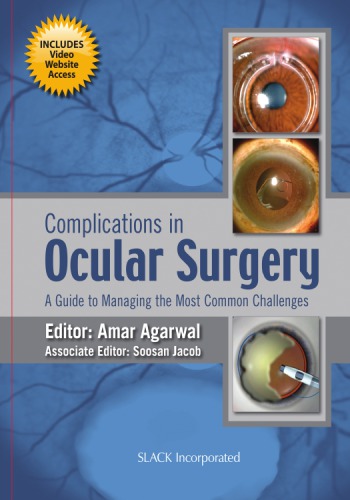 Complications In Ocular Surgery A Guide To Managing The Most Common Challenges Agarwal