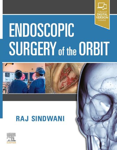Endoscopic Surgery Of The Orbit 1st Edition Raj Sindwani