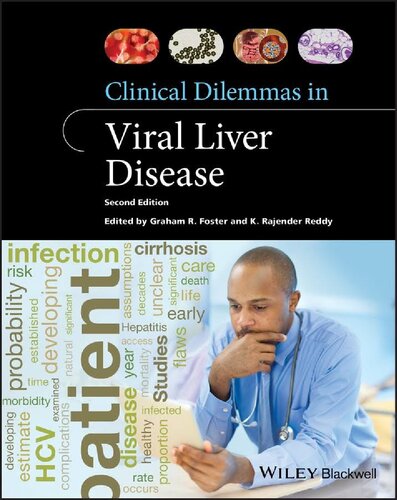 Clinical Dilemmas In Viral Liver Disease Clinical Dilemmas Uk 2nd Edition Graham R Foster Editor