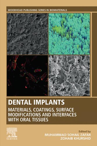Dental Implants 1st Edition Muhammad Sohail Zafar Zohaib Khurshid