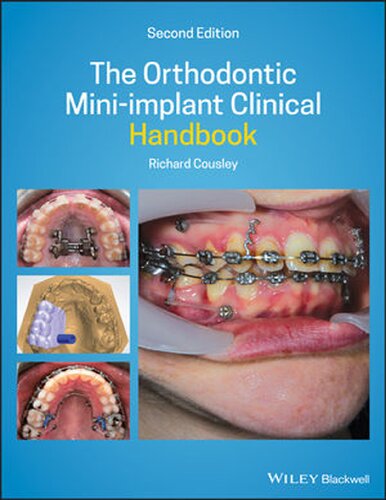 The Orthodontic Miniimplant Clinical Handbook 2nd Edition Richard Cousley