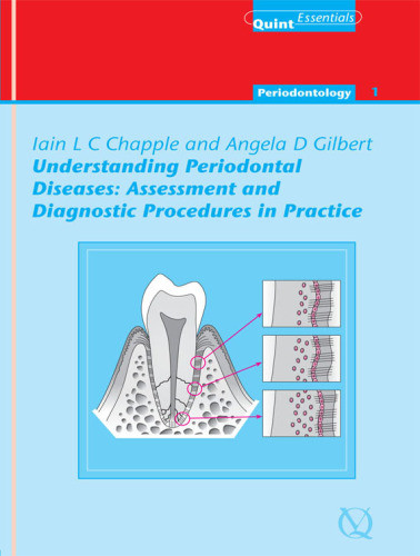 Understanding Periodontal Diseases Quintessentials Of Dental Practice Vol 1 Chapple