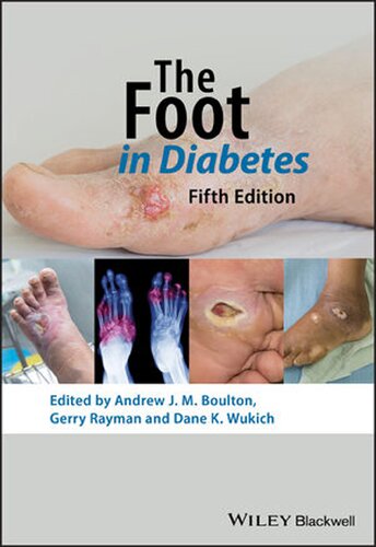The Foot In Diabetes Practical Diabetes 5th Edition Andrew J M Boulton Editor