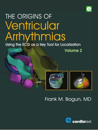 The Origins Of Ventricular Arrhythmias Using The Ecg As A Key Tool For Localization Volume 2 Frank M Bogun