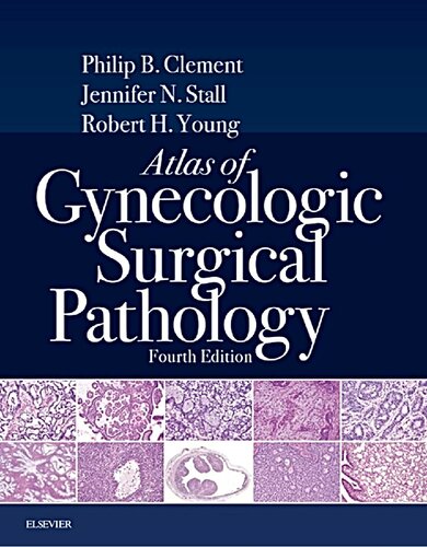 Atlas Of Gynecologic Surgical Pathology 4th Edition Philip B Clement Md