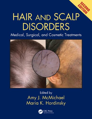 Hair And Scalp Disorders Medical Surgical And Cosmetic Treatments 2nd Edition Amy J Mcmichael Editor