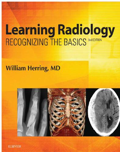 Learning Radiology Recognizing The Basics 3rd Edition Herring