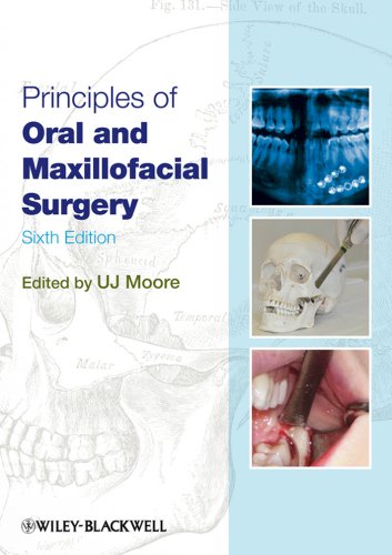 Principles Of Oral And Maxillofacial Surgery 6th Edition Moore