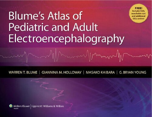 Blumes Atlas Of Pediatric And Adult Electroencephalography 1st Edition Warren T Blume