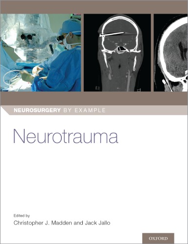Neurotrauma Neurosurgery By Example 1st Christopher J Madden