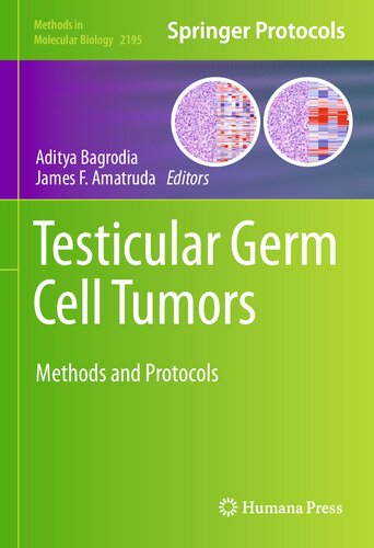 Testicular Germ Cell Tumors Methods And Protocols 1st Edition Aditya Bagrodia Editor