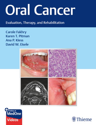 Oral Cancer Evaluation Therapy And Rehabilitation 1st Carole Fakhry