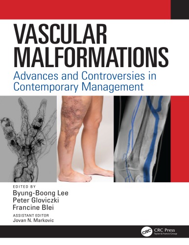 Vascular Malformations Advances And Controversies In Contemporary Management 1st Byung Boong Lee