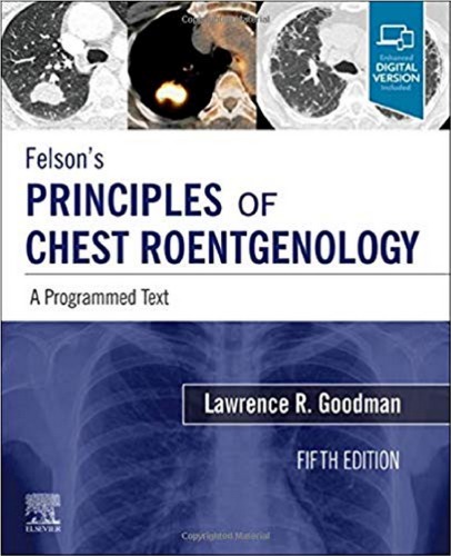 Felsons Principles Of Chest Roentgenology A Programmed Text 5th Edition Lawrence Goodman