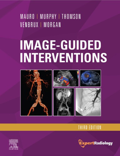 Imageguided Interventions Expert Radiology Series 3rd Edition Matthew A Mauro