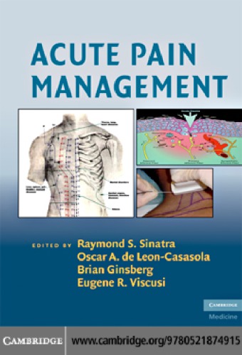 Acute Pain Management De Leoncassasola Oscar Aginsberg Brianmcquay