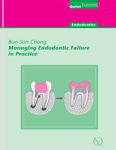 Managing Endodontic Failure In Practice Quintessentials Of Dental Practice Vol 23 Chong