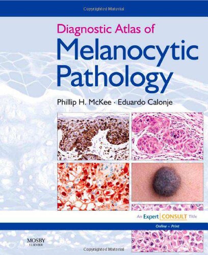 Diagnostic Atlas Of Melanocytic Pathology 1st Edition Phillip H Mckee