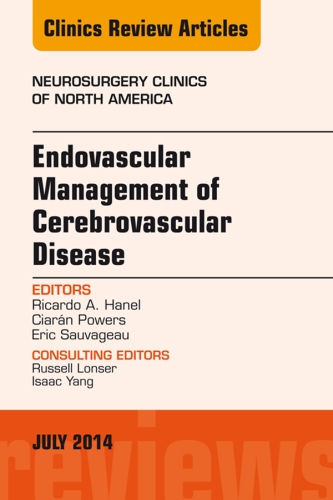 Endovascular Management Of Cerebrovascular Disease Dr Ricardo A Hanel