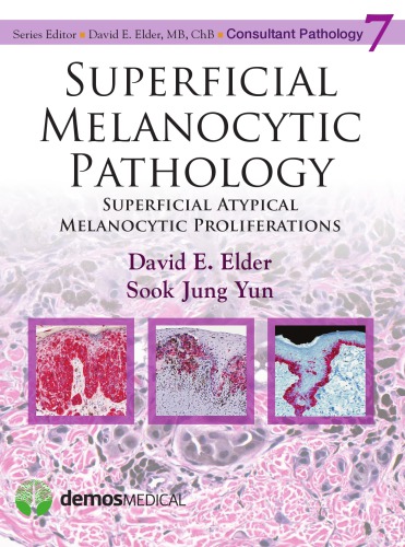 Superficial Melanocytic Pathology Superficial Atypical Melanocytic Proliferations Elder