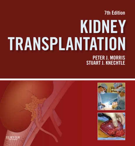 Kidney Transplantation Principles And Practice 7th Edition Elsevierknechtle