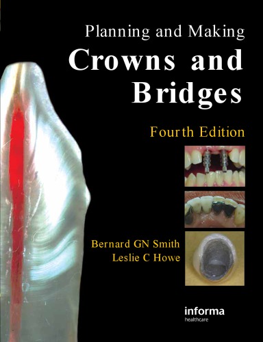 Planning And Making Crowns And Bridges 4th Edition Howe Leslie Csmith