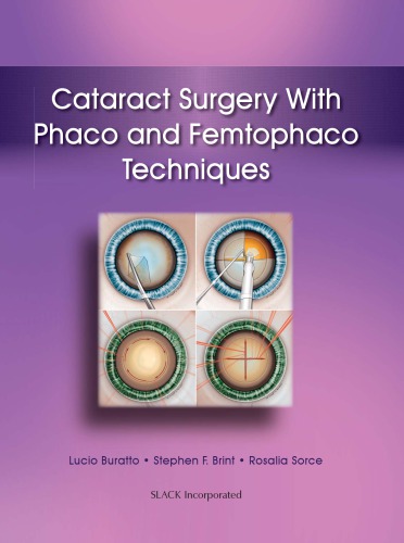 Cataract Surgery Phaco And Femtophaco Techniques Brint Stephenburatto