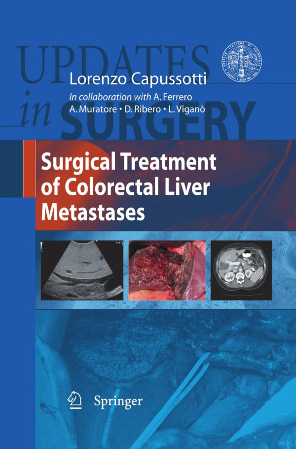 Surgical Treatment Of Colorectal Liver Metastases 1st Edition Dario Ribero Auth