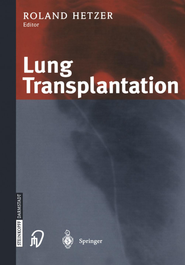 Lung Transplantation 1st Edition H C Doerge G Wieselthaler